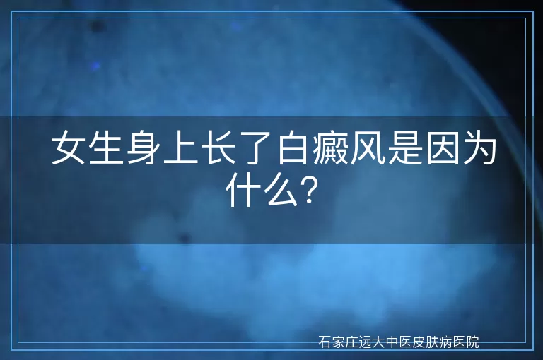 女生身上长了白癜风是因为什么？