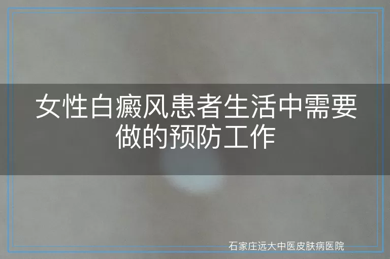 女性白癜风患者生活中需要做的预防工作