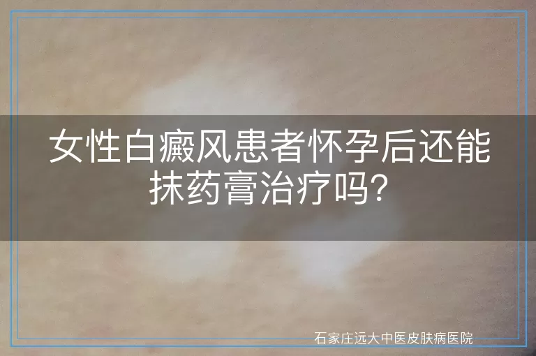 女性白癜风患者怀孕后还能抹药膏治疗吗？