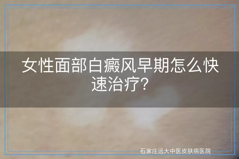 女性面部白癜风早期怎么快速治疗？