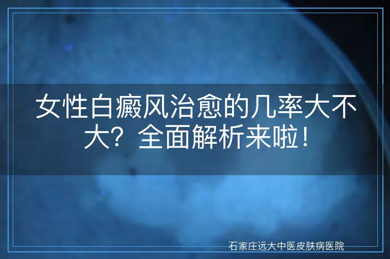 女性白癜风治愈的几率大不大？全面解析来啦！