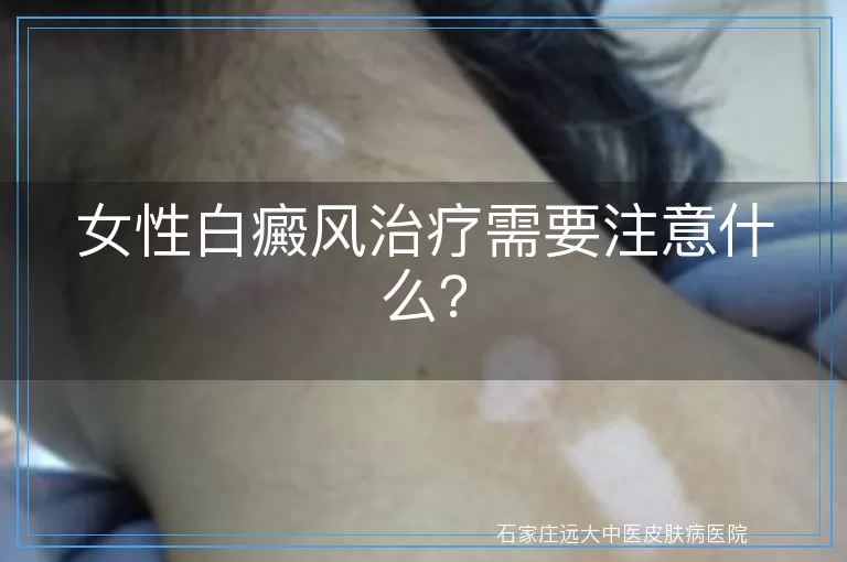 女性白癜风治疗需要注意什么？