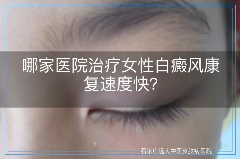 哪家医院治疗女性白癜风康复速度快？