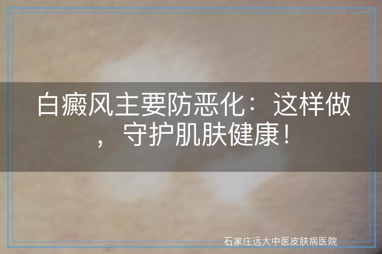 白癜风主要防恶化：这样做，守护肌肤健康！