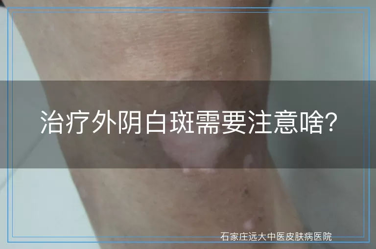 治疗外阴白斑需要注意啥？