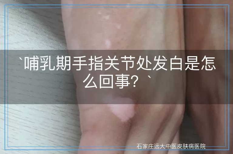 哺乳期手指关节处发白是怎么回事？