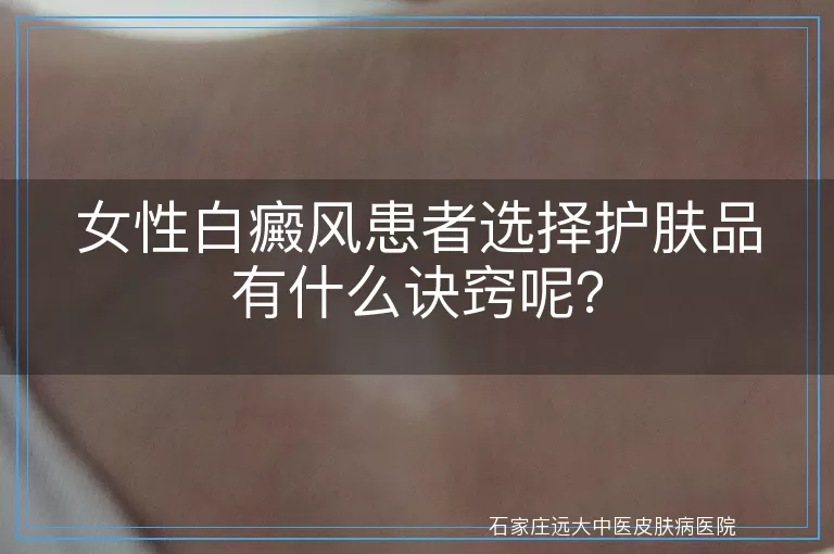 女性白癜风患者选择护肤品有什么诀窍呢？