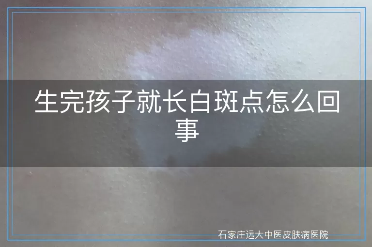 生完孩子就长白斑点怎么回事