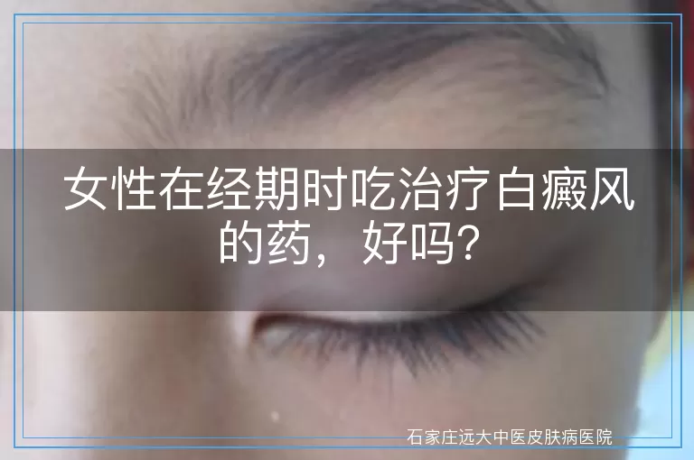 女性在经期时吃治疗白癜风的药，好吗？