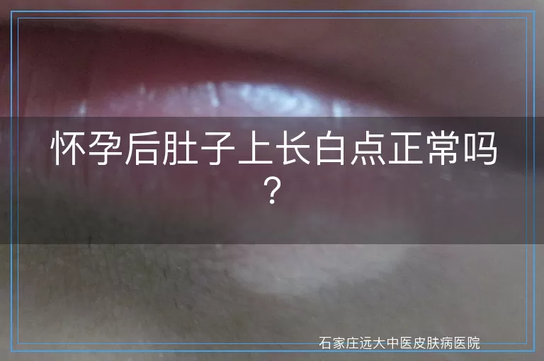 怀孕后肚子上长白点正常吗？