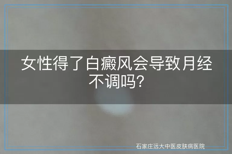 女性得了白癜风会导致月经不调吗？