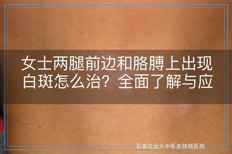 女士两腿前边和胳膊上出现白斑怎么治？全面了解与应对