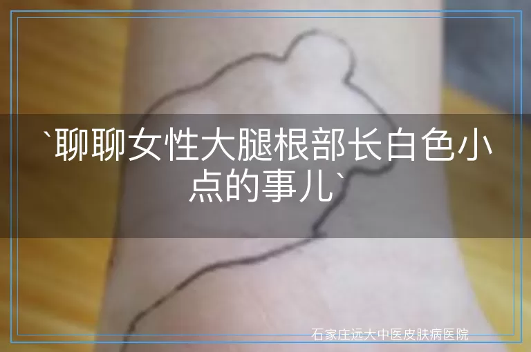 聊聊女性大腿根部长白色小点的事儿
