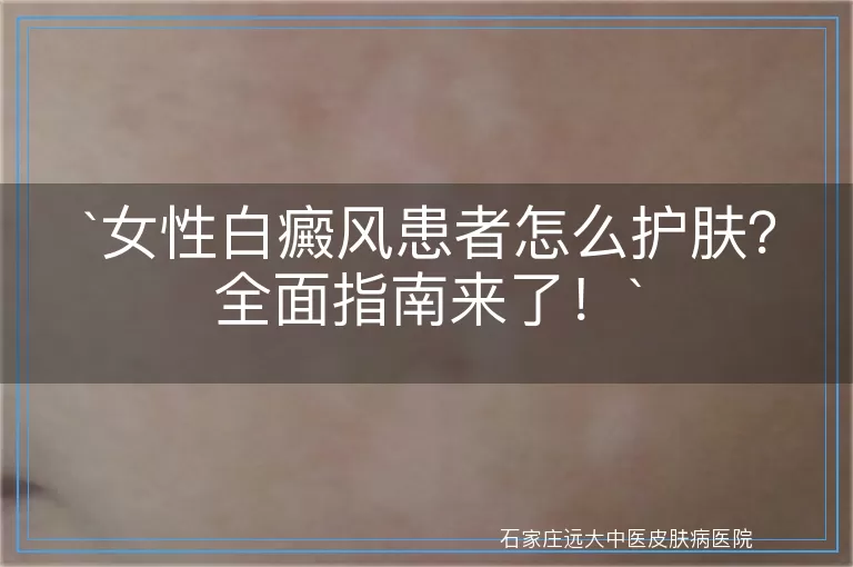 女性白癜风患者怎么护肤？全面指南来了！