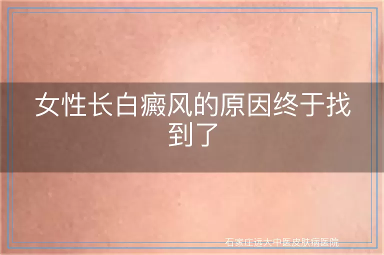 女性长白癜风的原因终于找到了
