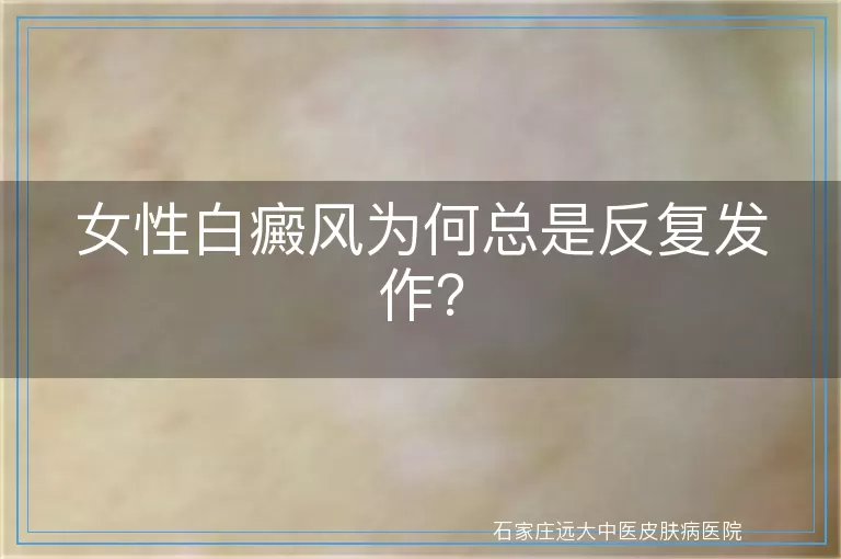 女性白癜风为何总是反复发作？