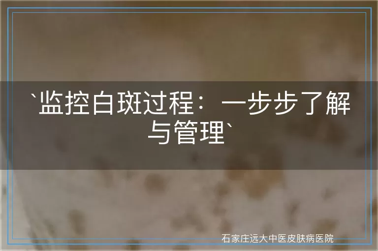监控白斑过程：一步步了解与管理