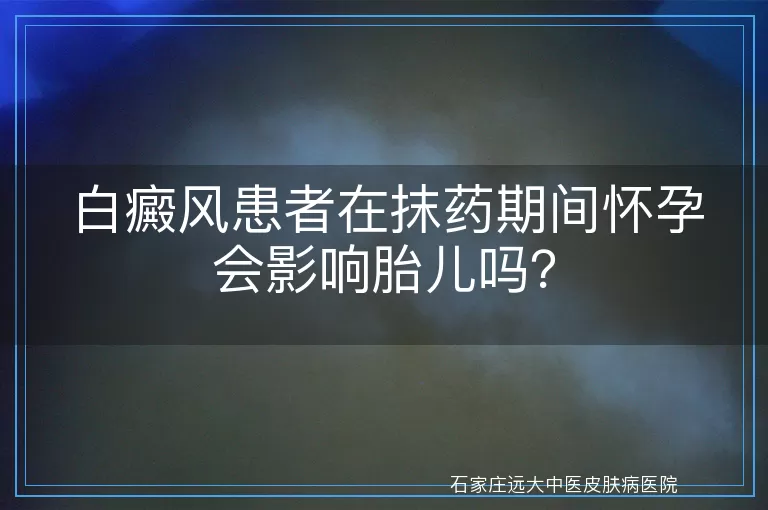 白癜风患者在抹药期间怀孕会影响胎儿吗？