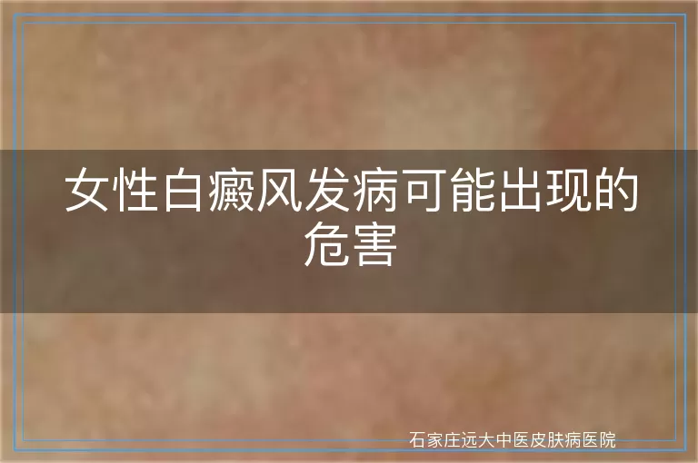 女性白癜风发病可能出现的危害