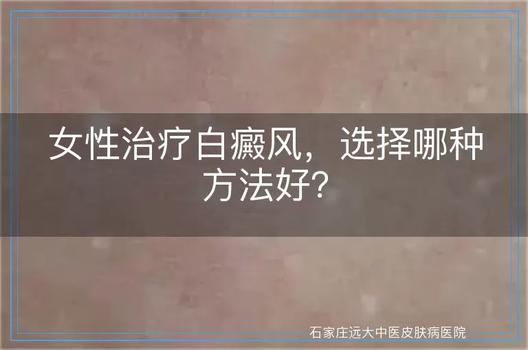 女性治疗白癜风，选择哪种方法好？