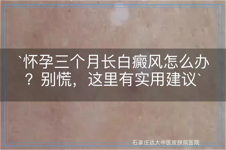怀孕三个月长白癜风怎么办？别慌，这里有实用建议