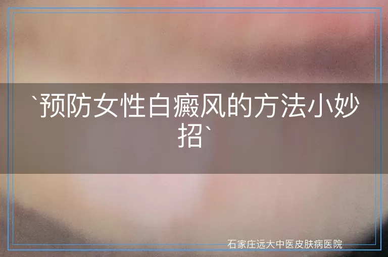 预防女性白癜风的方法小妙招