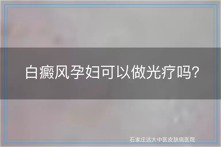 白癜风孕妇可以做光疗吗?