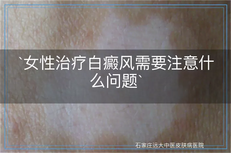 女性治疗白癜风需要注意什么问题