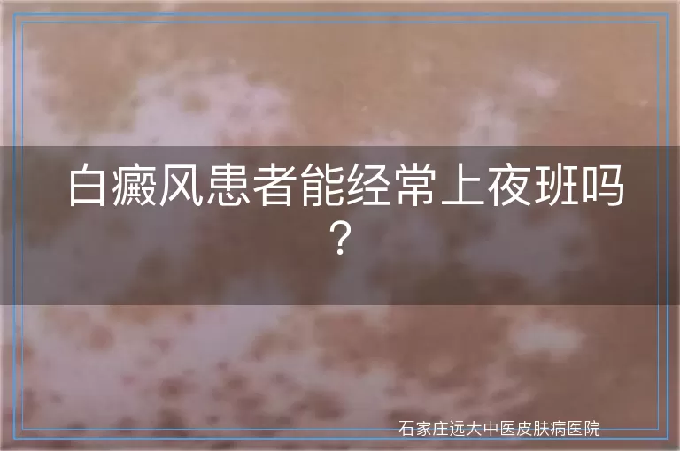 白癜风患者能经常上夜班吗?