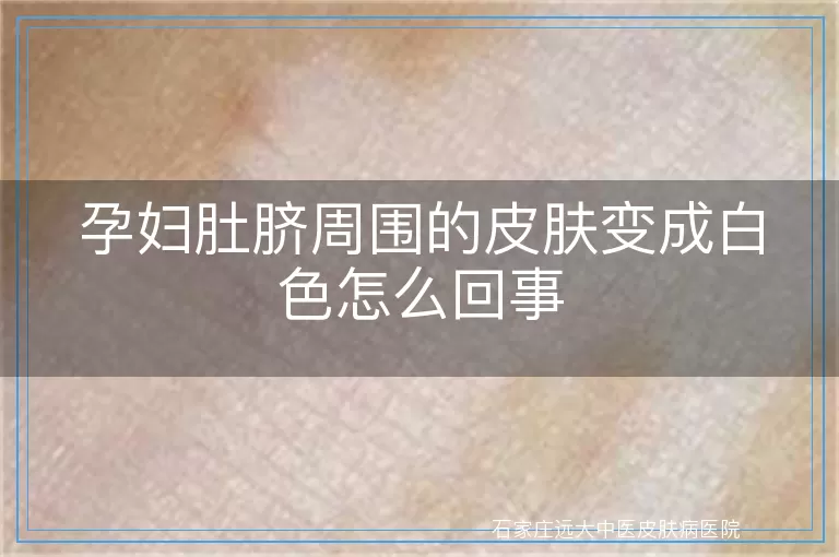 孕妇肚脐周围的皮肤变成白色怎么回事