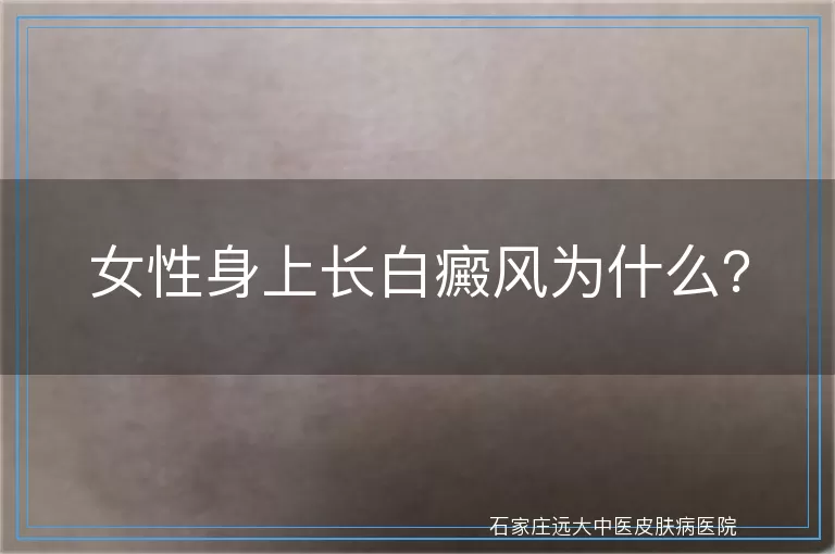 女性身上长白癜风为什么？
