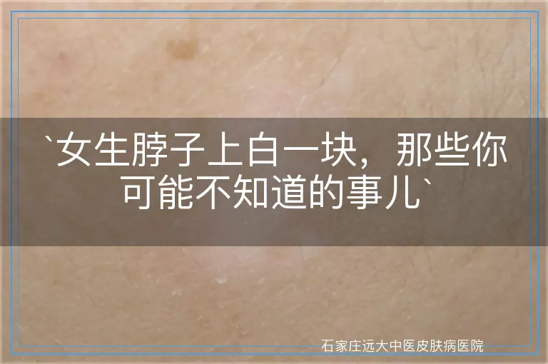 女生脖子上白一块，那些你可能不知道的事儿