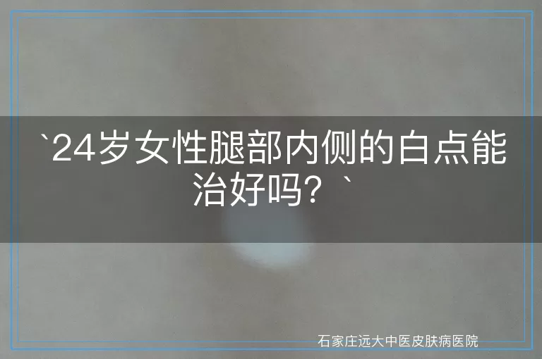24岁女性腿部内侧的白点能治好吗？