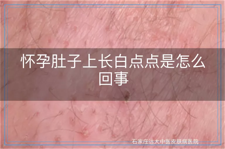 怀孕肚子上长白点点是怎么回事