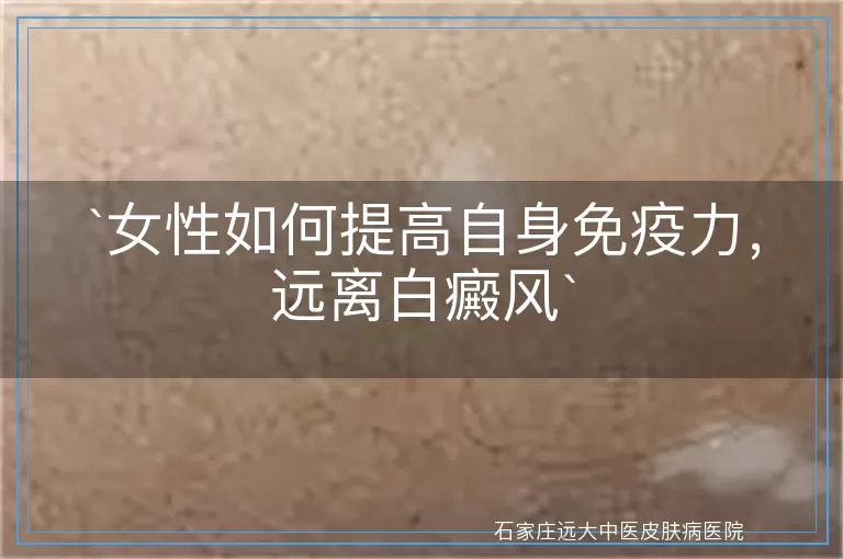 女性如何提高自身免疫力，远离白癜风