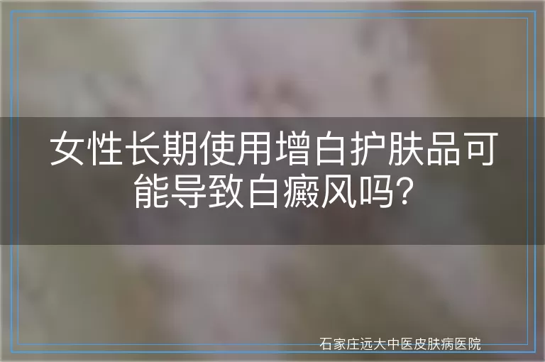 女性长期使用增白护肤品可能导致白癜风吗？