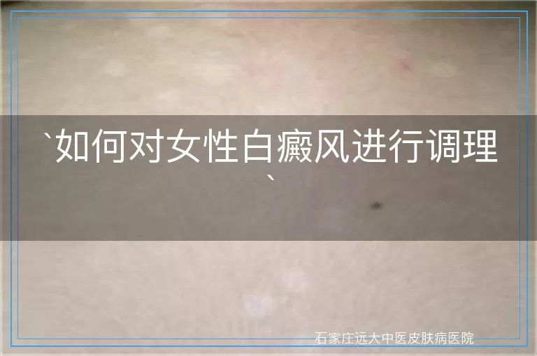 如何对女性白癜风进行调理