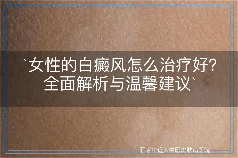 女性的白癜风怎么治疗好？全面解析与温馨建议