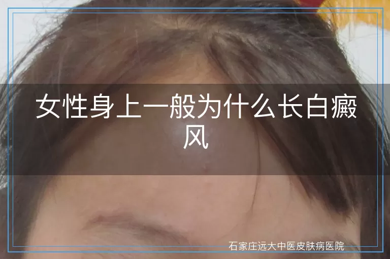 女性身上一般为什么长白癜风