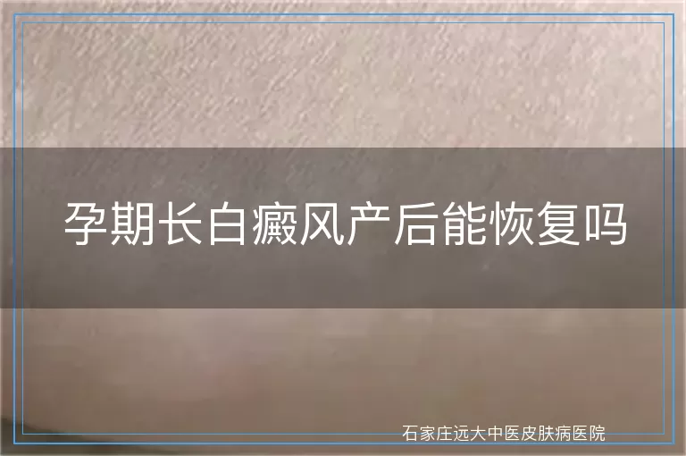 孕期长白癜风产后能恢复吗
