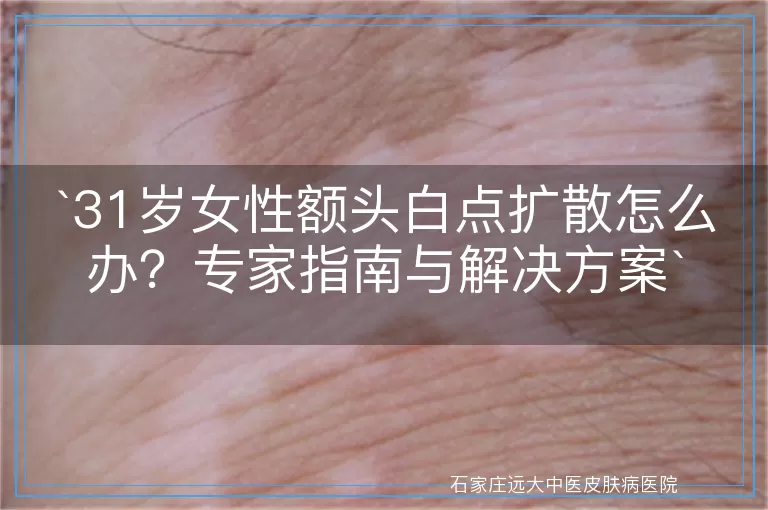 31岁女性额头白点扩散怎么办？专家指南与解决方案