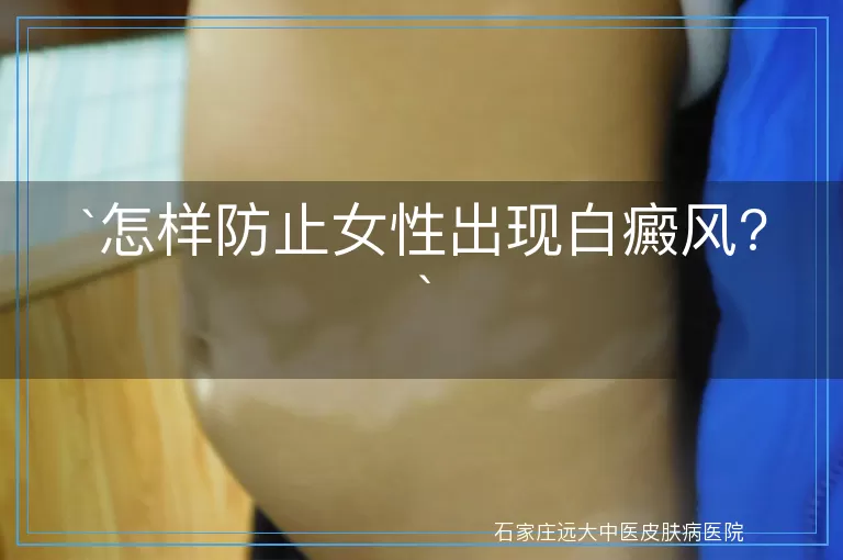 怎样防止女性出现白癜风?