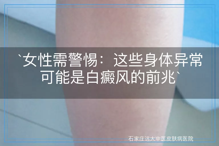 女性需警惕：这些身体异常可能是白癜风的前兆
