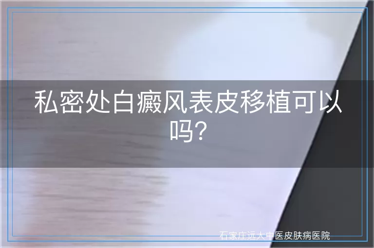私密处白癜风表皮移植可以吗？