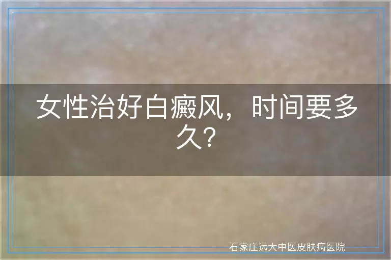 女性治好白癜风，时间要多久？