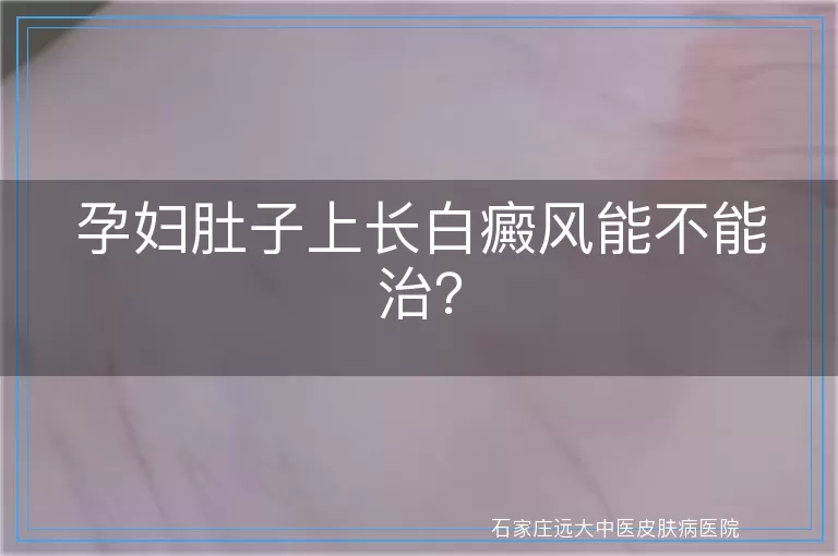 孕妇肚子上长白癜风能不能治？