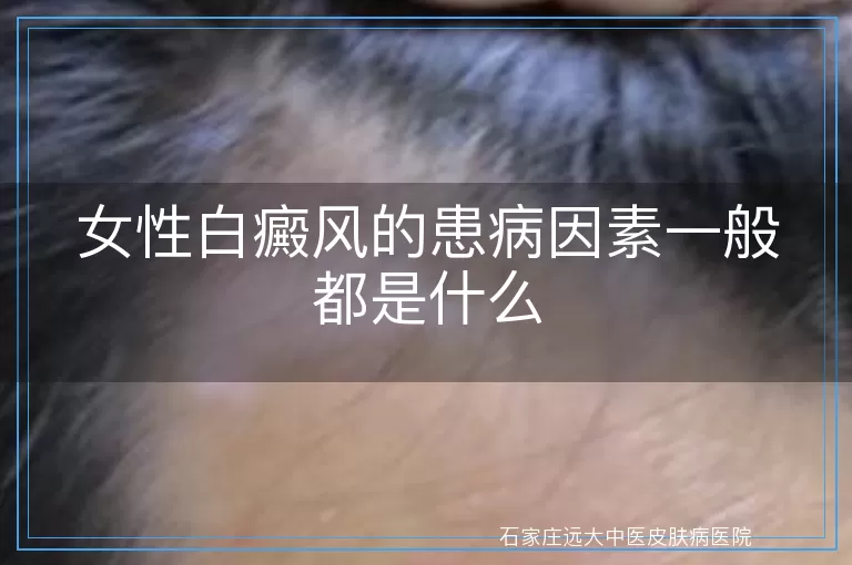 女性白癜风的患病因素一般都是什么