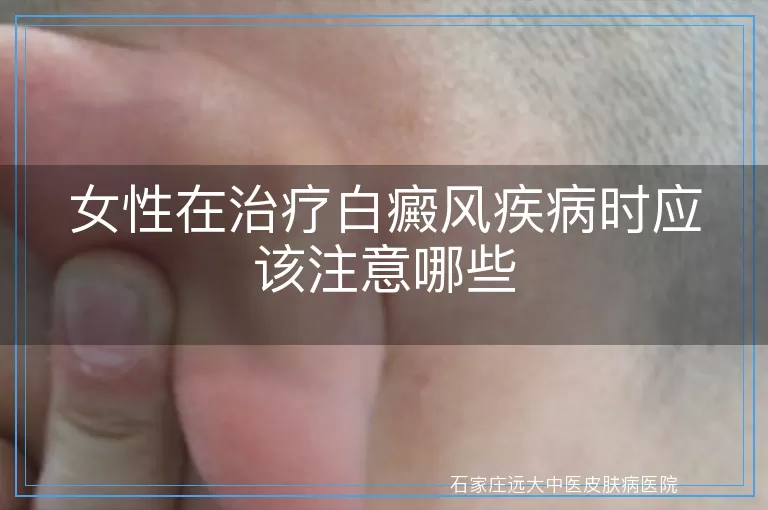 女性在治疗白癜风疾病时应该注意哪些