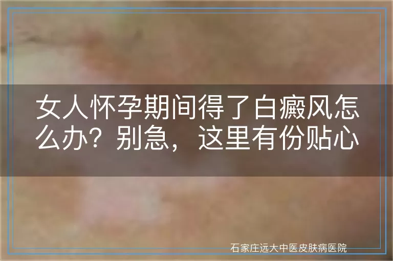 女人怀孕期间得了白癜风怎么办？别急，这里有份贴心指南！