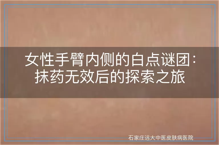 女性手臂内侧的白点谜团：抹药无效后的探索之旅